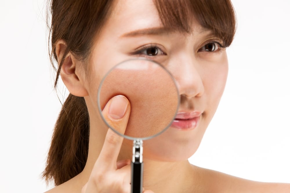 Phác đồ kem chống nắng cho da nám chuẩn y khoa 2 Da tăng sắc tố cần màng lọc vững chắc từ kem chống nắng cho da nám