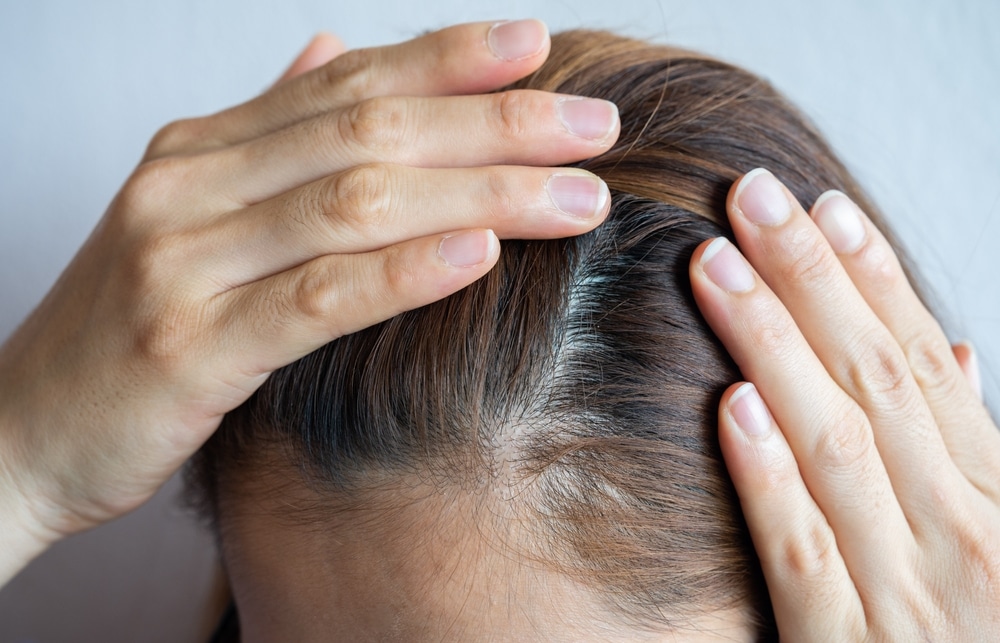 5 bí quyết chăm sóc tóc và da đầu mùa hè chuẩn chuyên gia 1 5 bí quyết chăm sóc tóc và da đầu mùa hè chuẩn chuyên gia