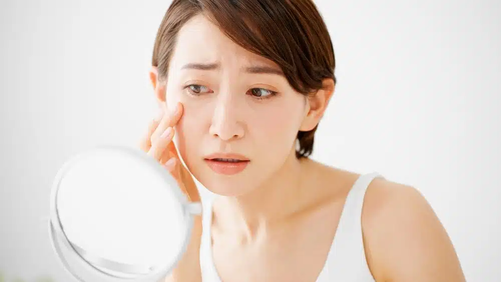 5 Dấu hiệu nhận biết da khô giao mùa và cách khắc phục sớm 2 5 Dấu hiệu cảnh báo bạn đang gặp phải tình trạng da khô giao mùa