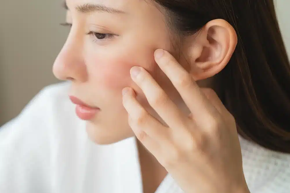 3 Bí quyết khóa ẩm cho da tự nhiên mùa thu đông 1 Khóa ẩm cho da là gì và tại sao bôi nhiều lớp dưỡng bề mặt vẫn khô rát?