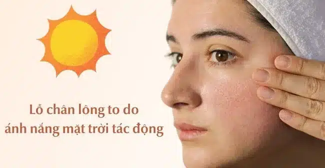 Tác động của tia UV đến lỗ chân lông - Nguyên nhân lỗ chân lông to mà phái đẹp chưa biết